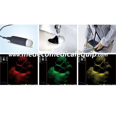 Mechanical Vet Ultrasound Scanner ME-VET5