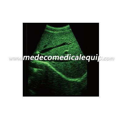 Full-Digital Laptop Ultrasound Scanner ME-370