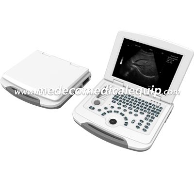 Full-Digital Laptop Ultrasound Scanner ME-500