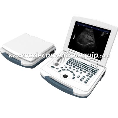 Full-Digital Laptop Ultrasound Scanner ME-580