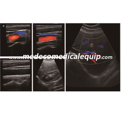 Laptop Color Doppler Ultrasound Scanner (Basic 4D Model) ME-L3 