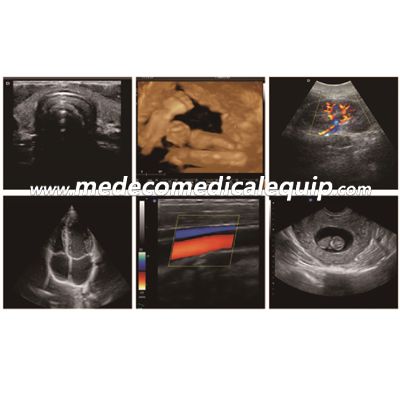 Laptop Color Doppler Ultrasound Scanner ME-L5