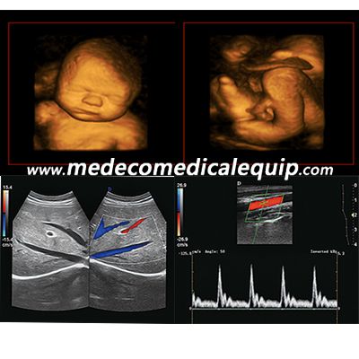 Portable Color Doppler 4D Ultrasound scanner ME-P6