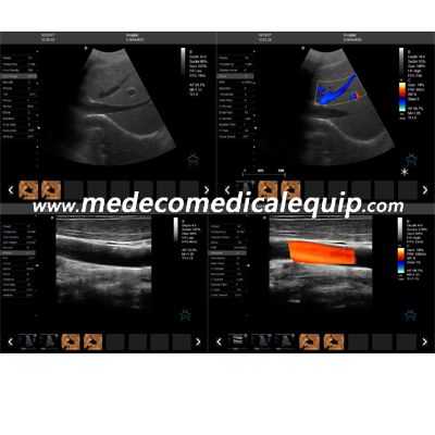 Trolley 4D Color Doppler Ultrasound scanner ME-T5