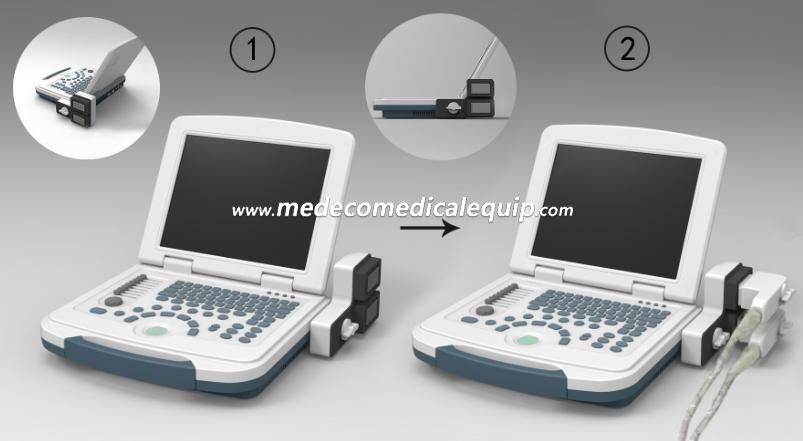 Full-Digital Laptop Ultrasound Scanner ME-500