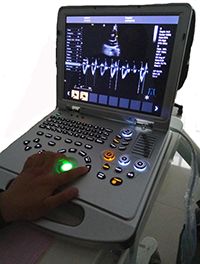 Laptop Color Doppler Ultrasound Scanner ME-L5