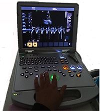 Laptop Color Doppler Ultrasound Scanner ME-L5