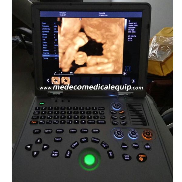 Laptop Color Doppler Ultrasound Scanner ME-L5