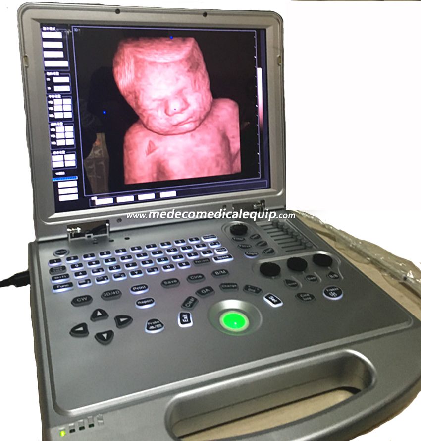 Laptop Color Doppler Ultrasound Scanner ME-L5