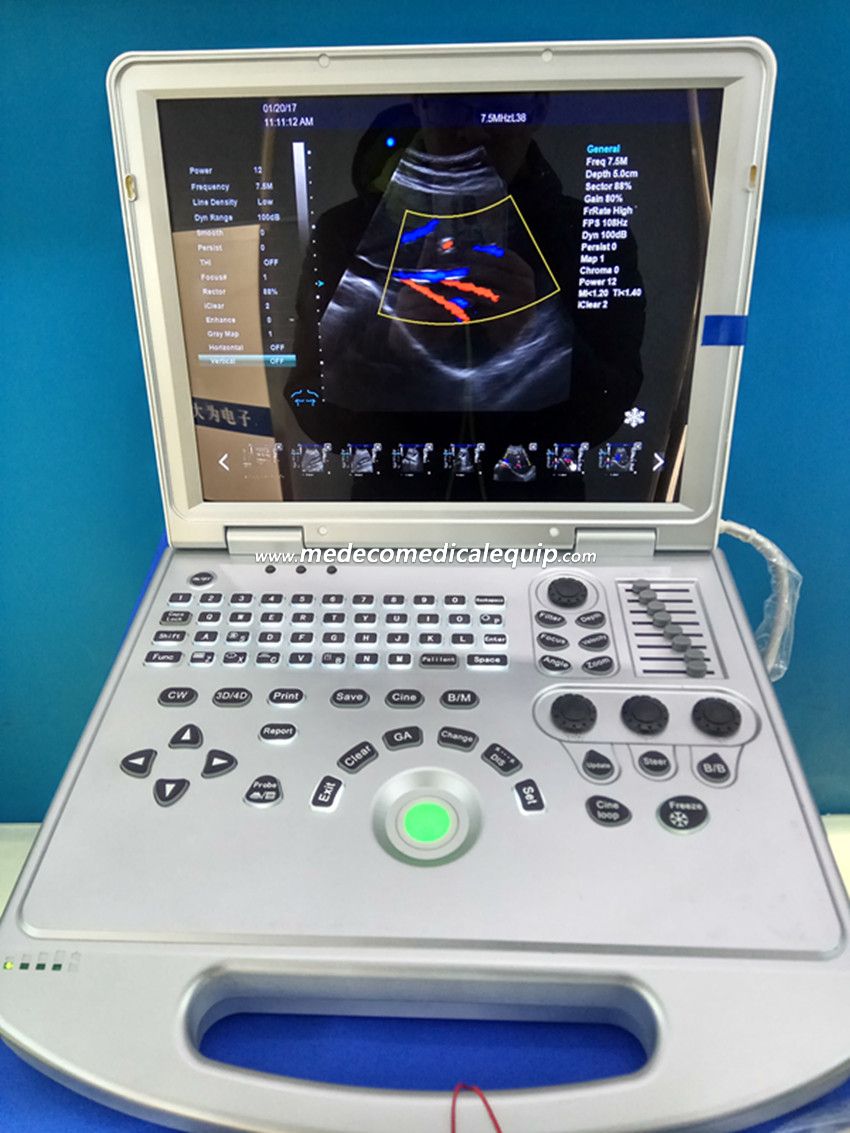 Laptop Color Doppler Ultrasound Scanner ME-L5