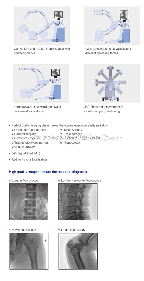 Mobile Digital FPD C-arm System MEX118F