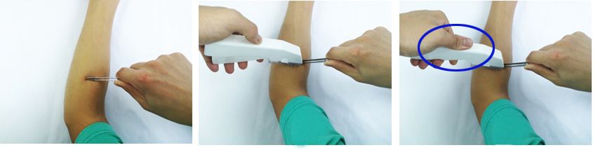 Disposable Skin Surgical Staplers and Stapler Removers with CE Certificate